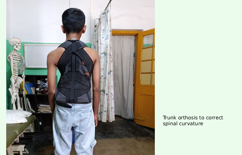Trunk_orth1