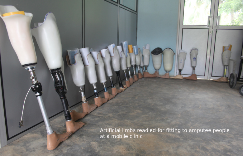 limbs waiting for fitting
