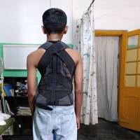 Modular Trunk Orthosis